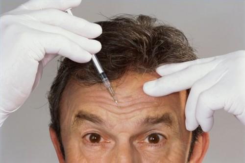 Comment traiter les migraines avec Botox