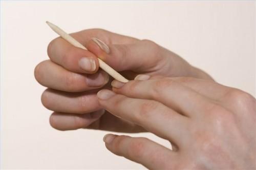 Comment traiter les champignons des ongles